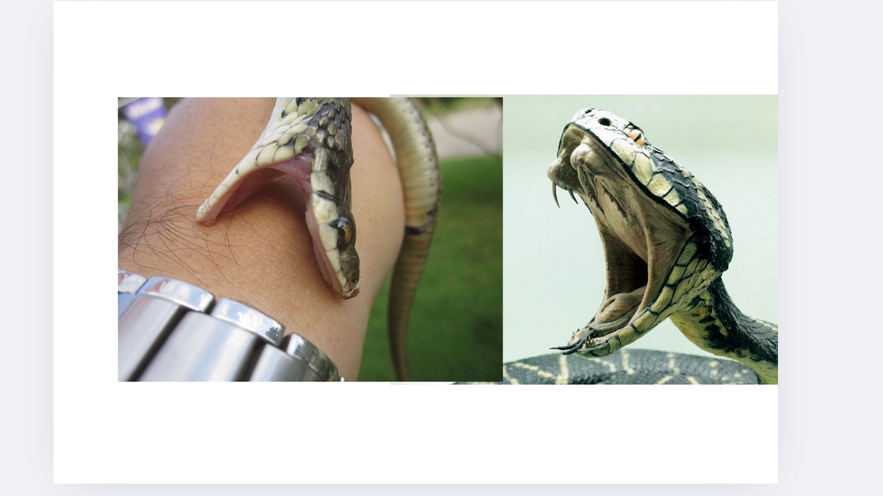 snake bite, venom, antivenom, self-experimentation, scientific study